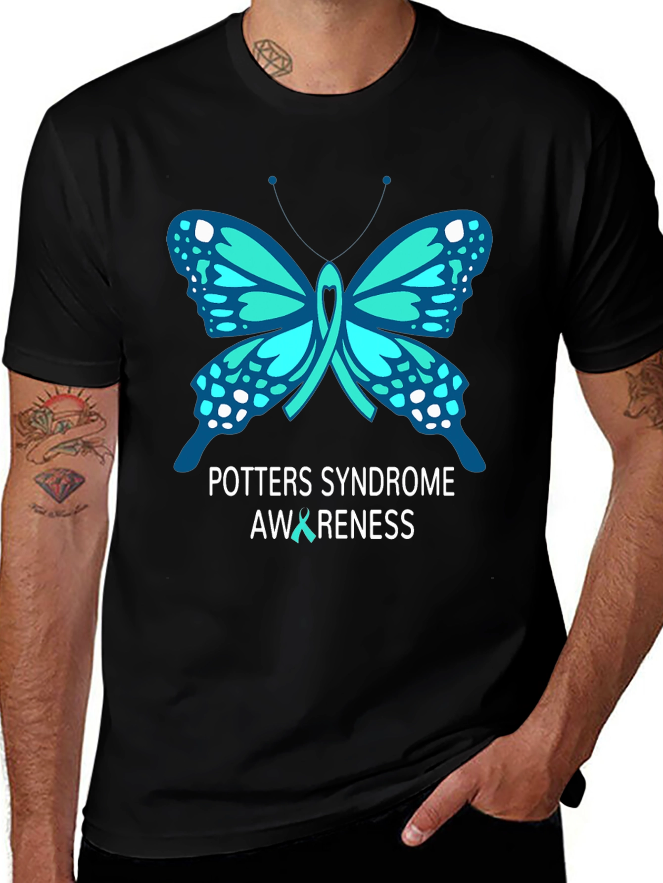 Potter's Syndrome Awareness Butterfly T-Shirt