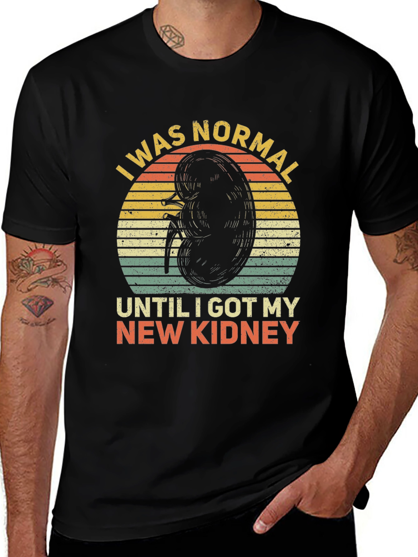 Variant 18 of I Was Normal Until I Got My New Kidney T-Shirt