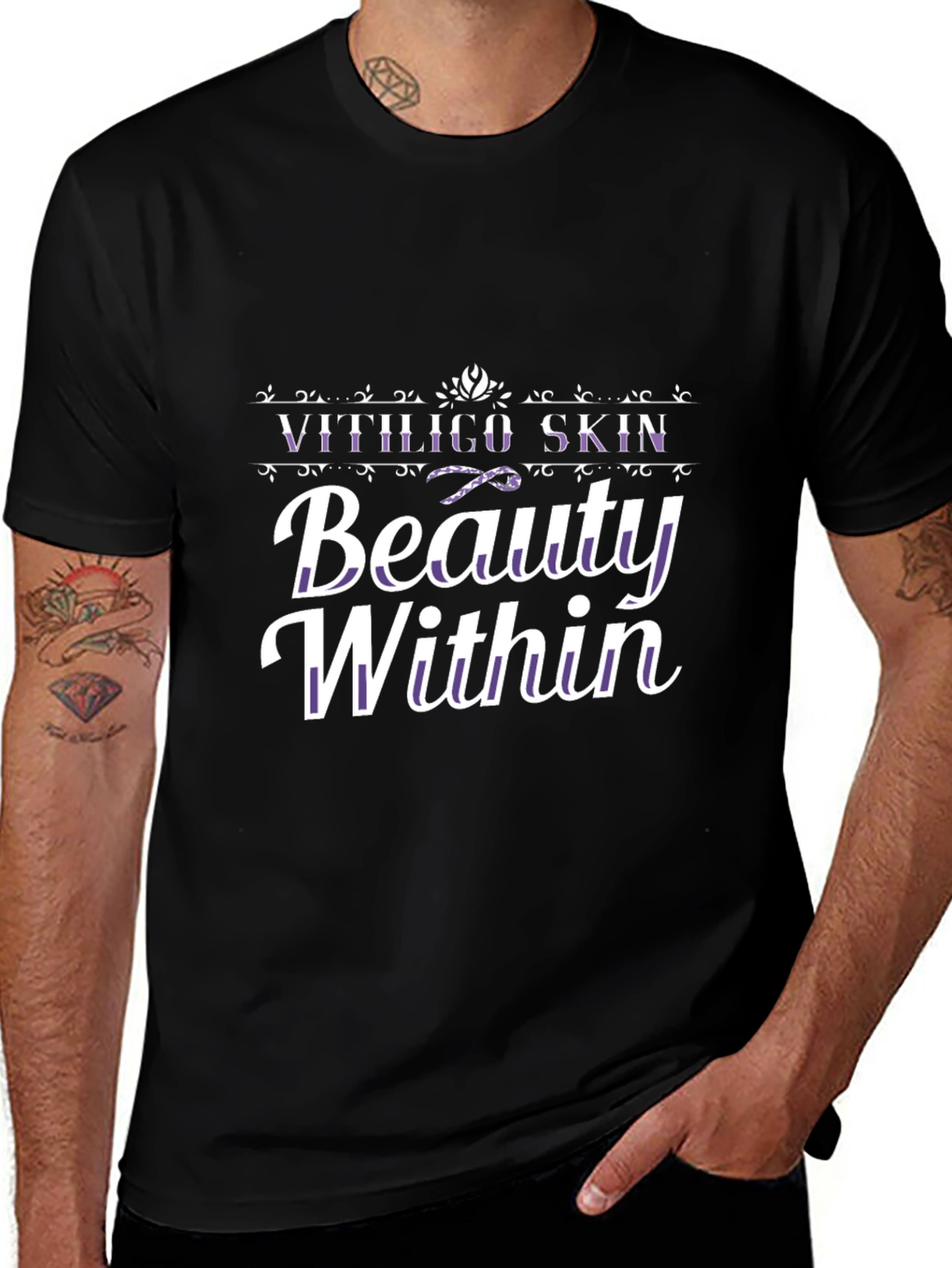 Variant 23 of Vitiligo Skin Beauty Within Black Graphic Tee