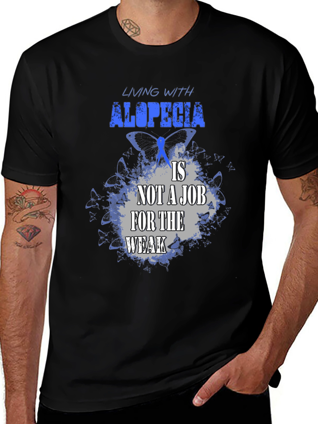 Alopecia Awareness T-Shirt - Living With Alopecia