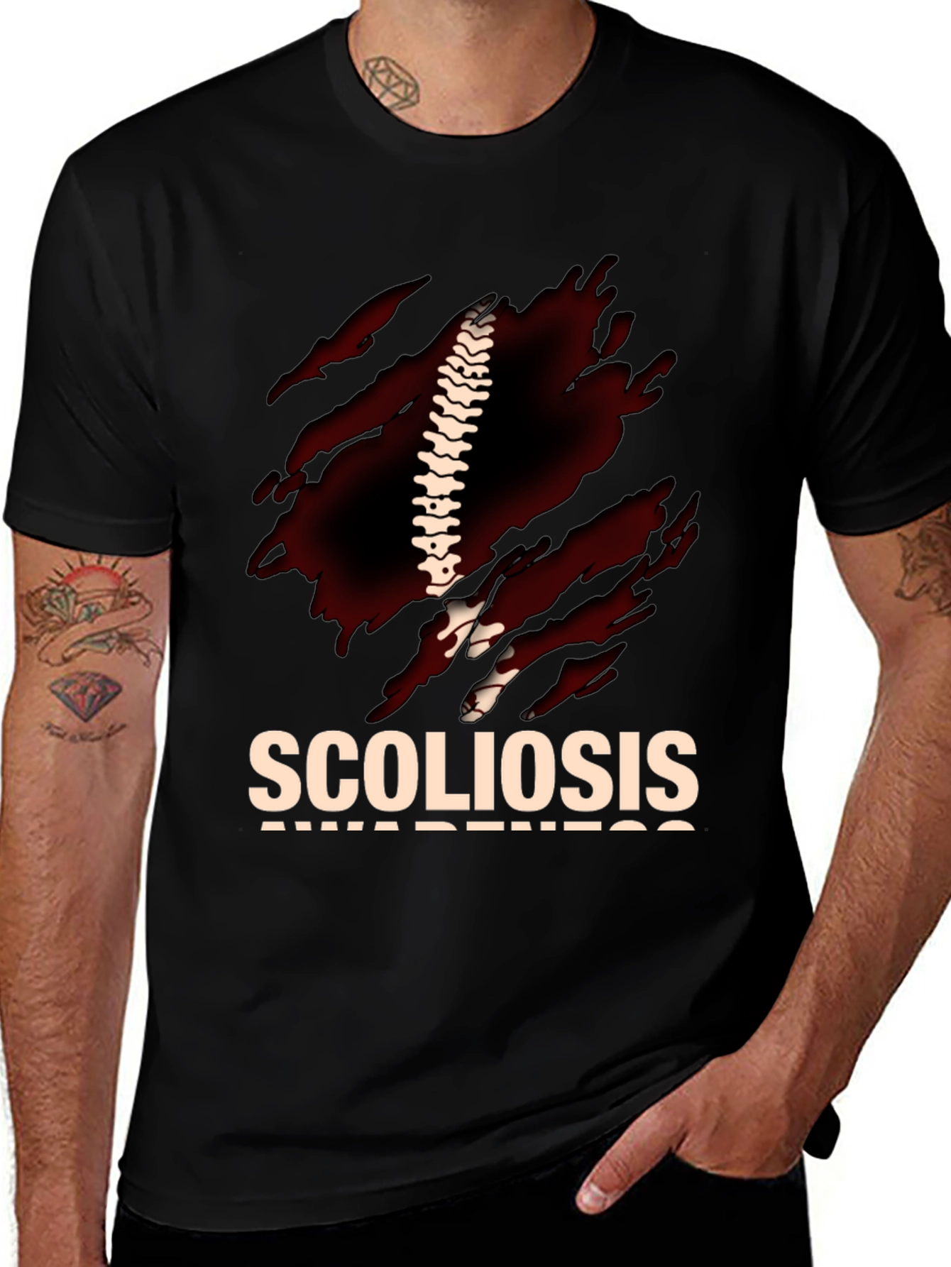 Scoliosis Awareness Graphic T-Shirt