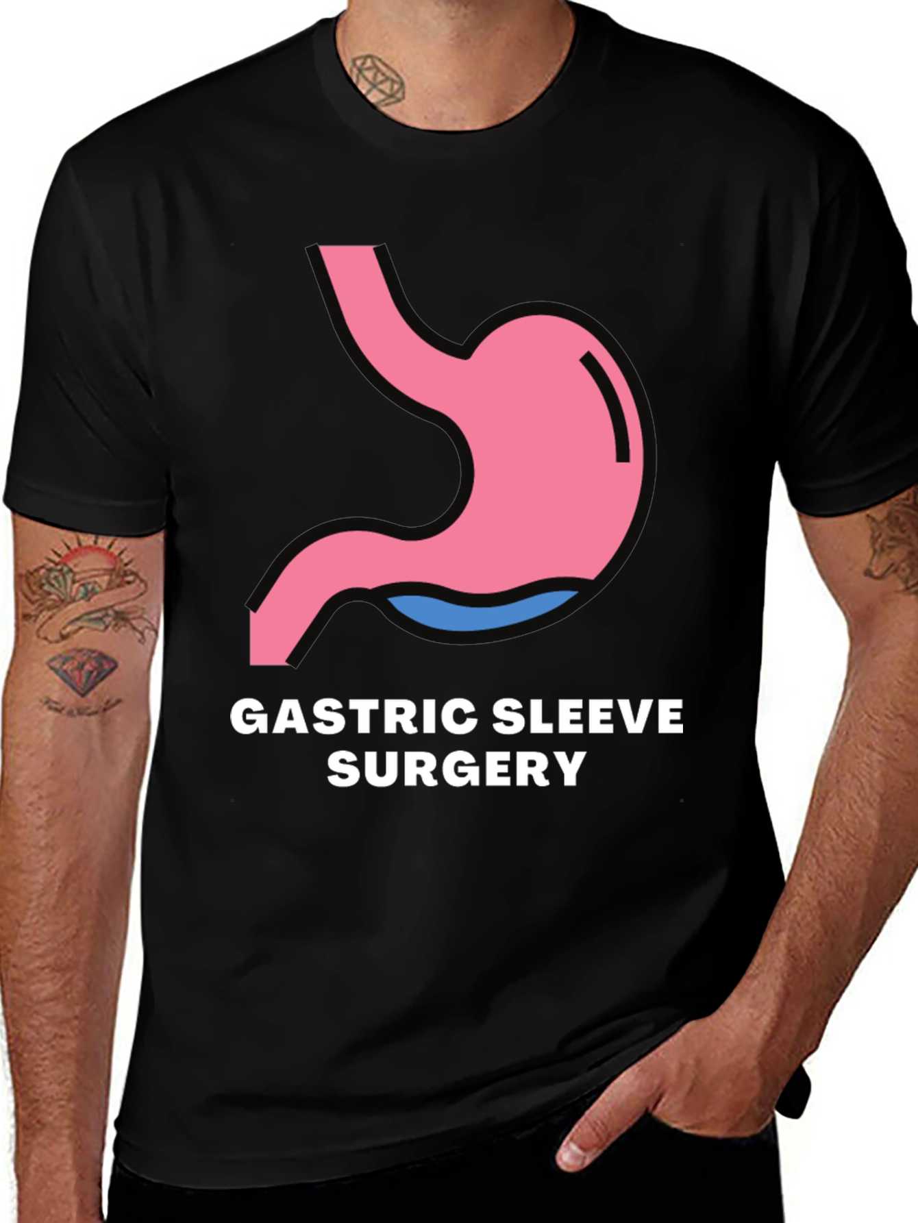 Gastric Sleeve Surgery Graphic Tee - Black T-Shirt