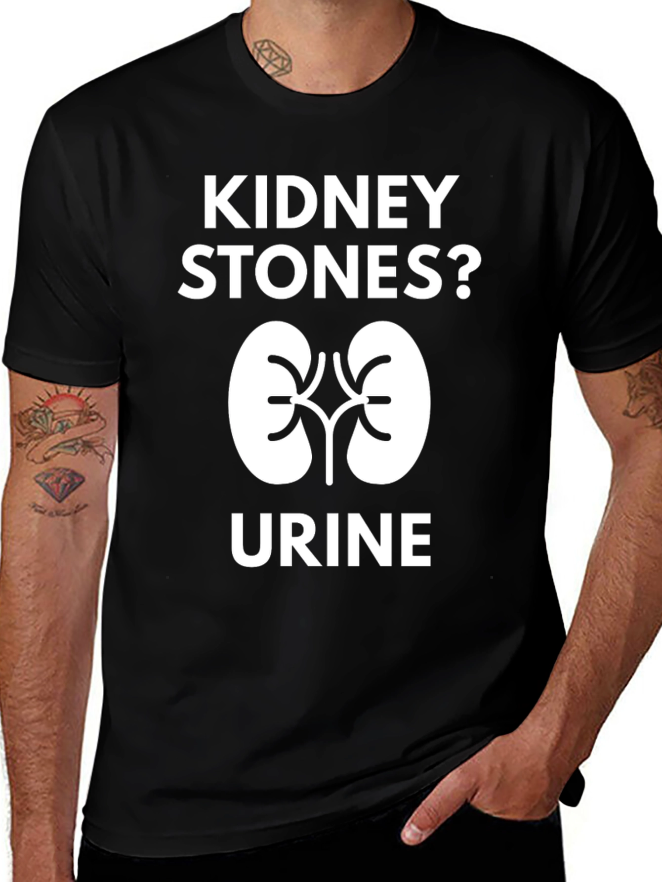 Variant 20 of Kidney Stones? Ur-ine T-Shirt - Funny Medical Humor Tee
