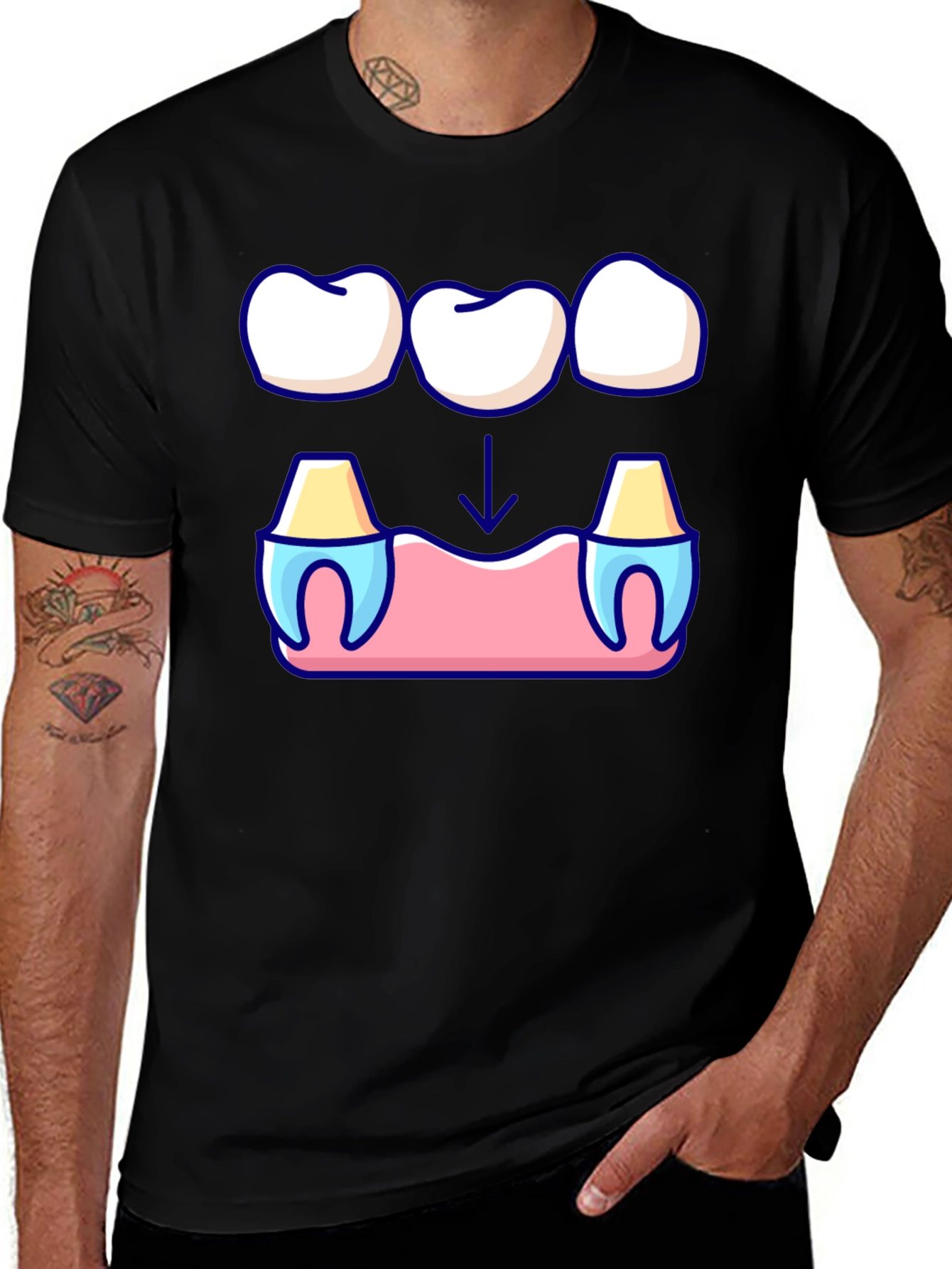 Variant 14 of Dental Bridge Graphic T-Shirt