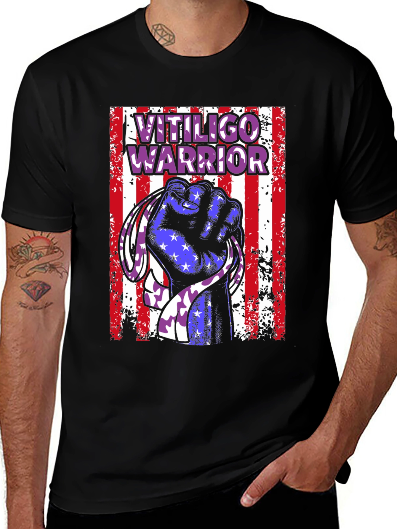 Vitiligo Warrior T-Shirt - Show Your Support!