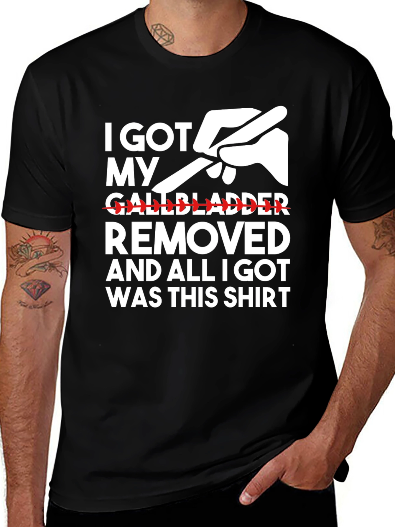 Variant 22 of Gallbladder Surgery T-Shirt - I Got My Removed Gift Tee