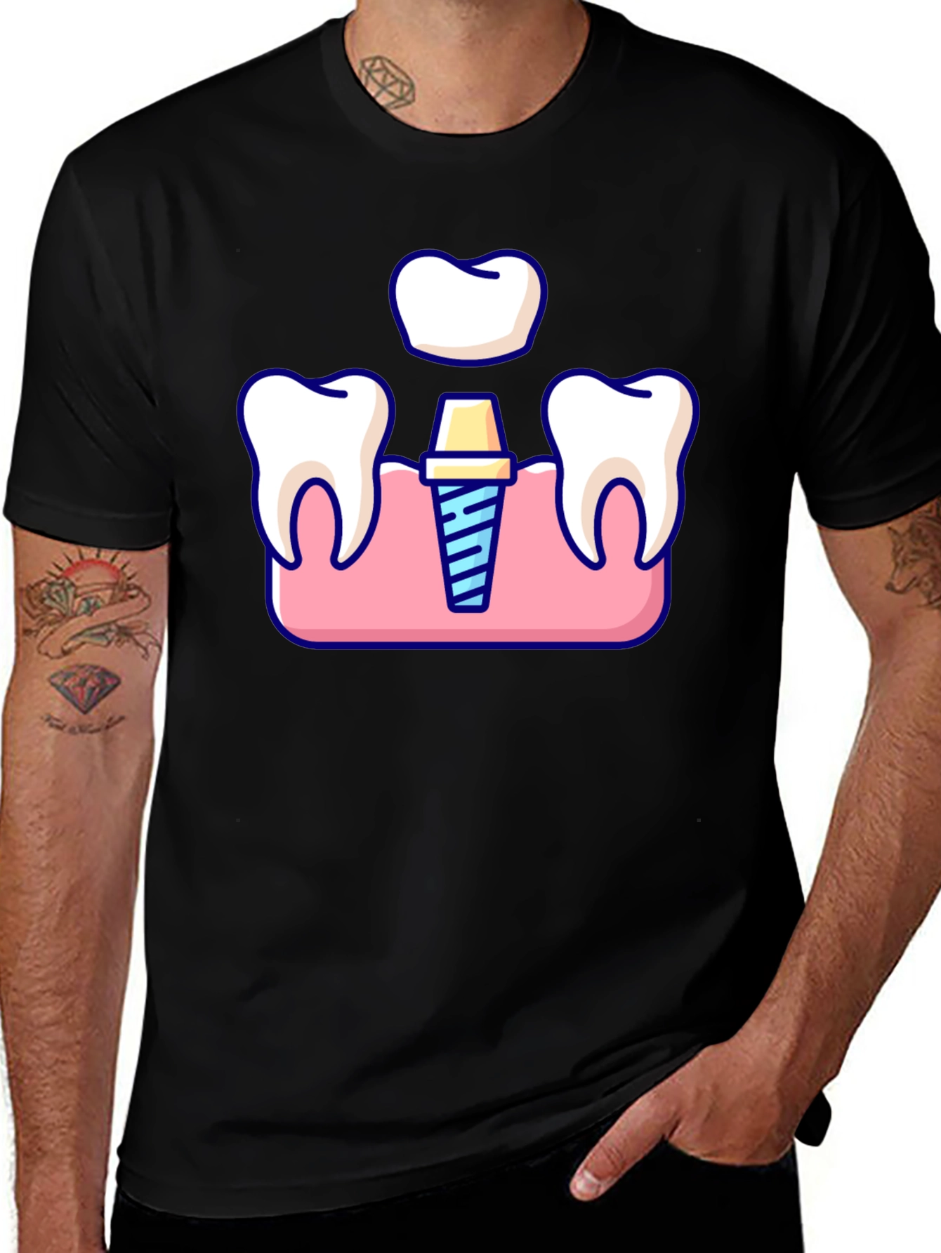 Dental Implant T-Shirt