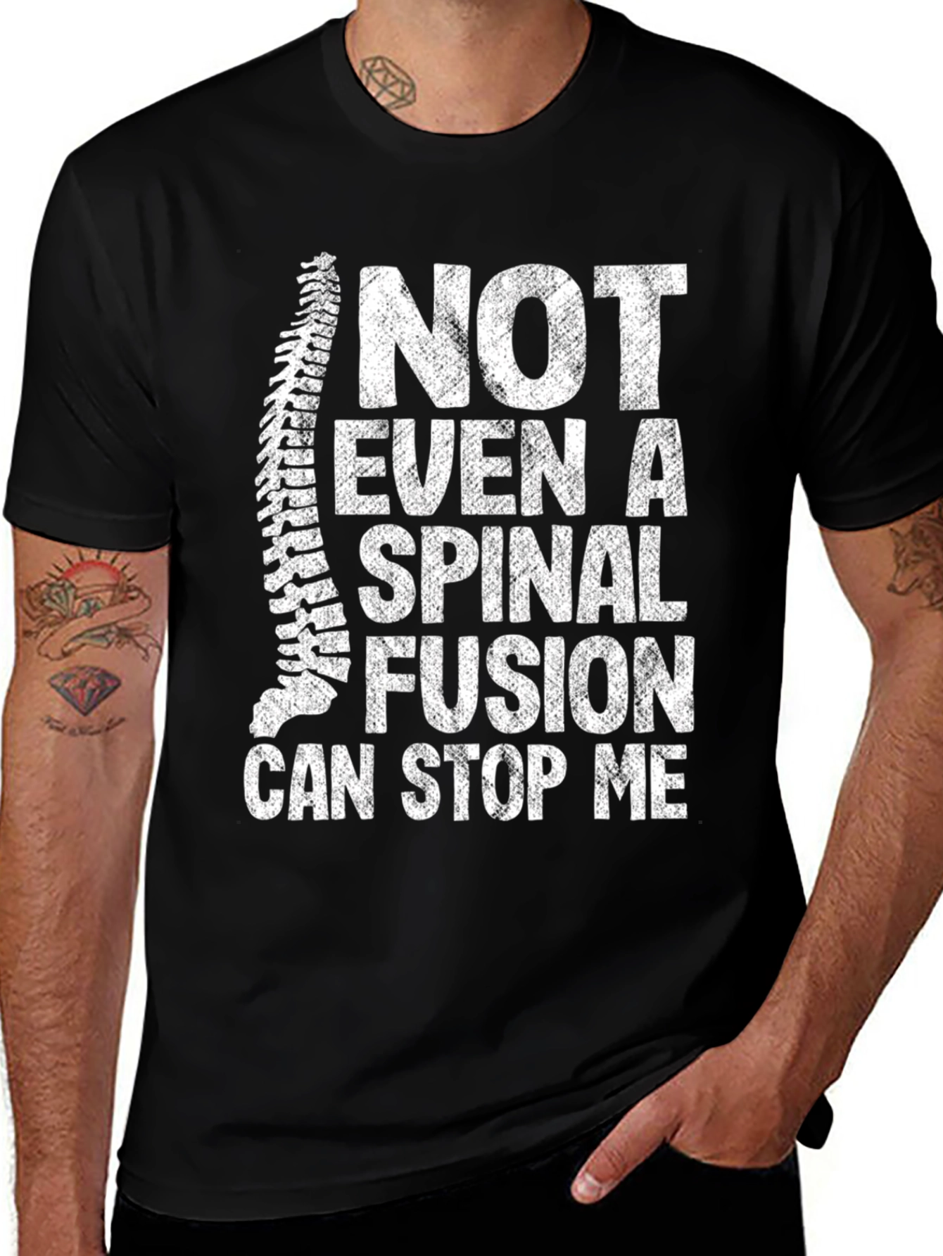 Variant 28 of Spinal Fusion Can't Stop Me T-Shirt