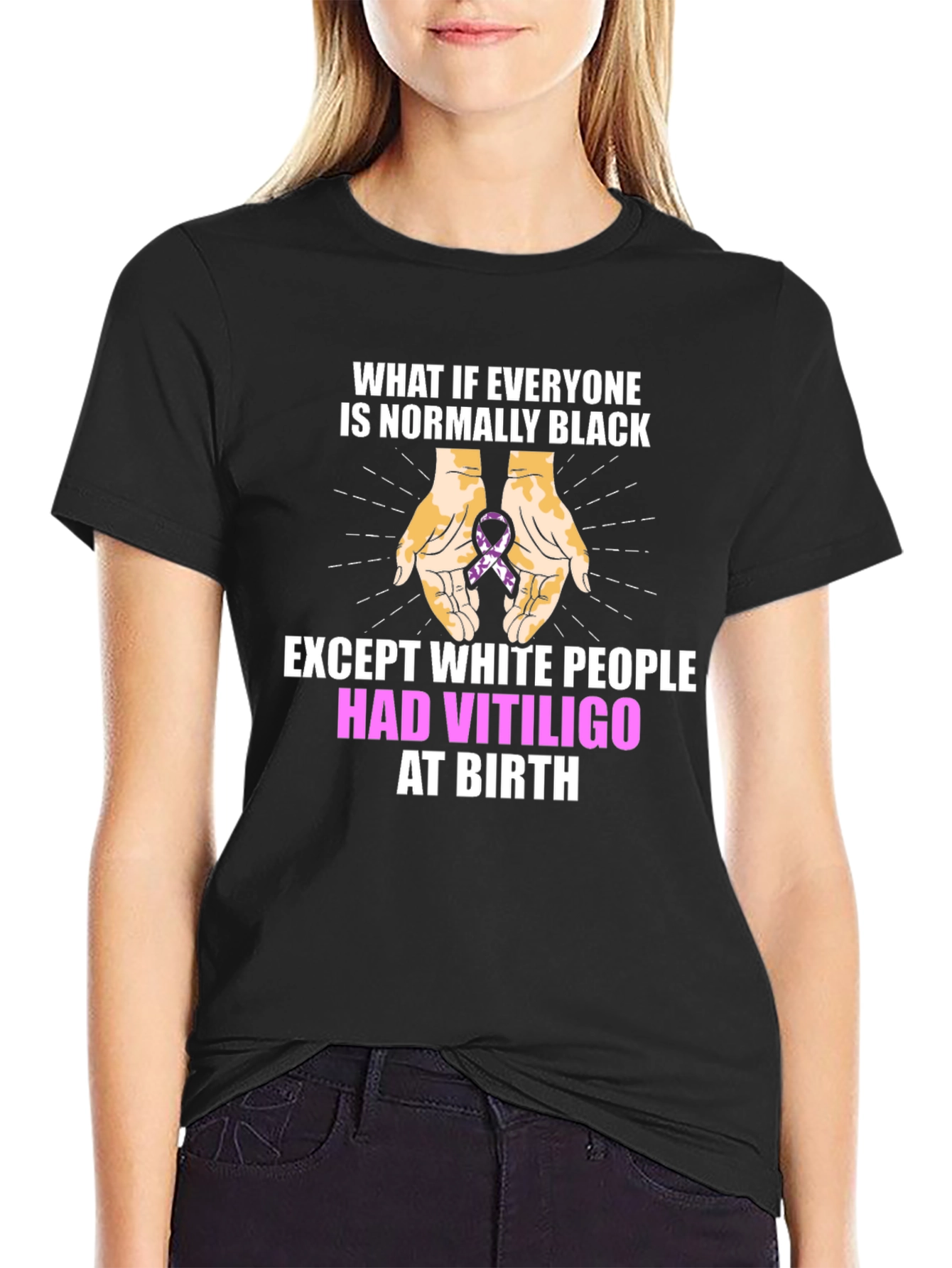 Black Vitiligo Awareness T-Shirt - Equality Design view 2